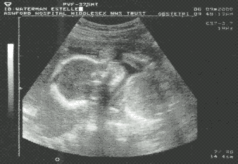 ultrasound 3