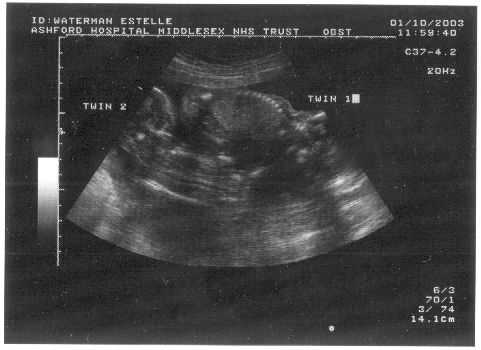 16 wk scan